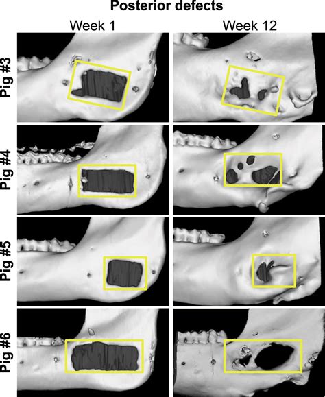 establishing  critical size mandibular defect model  growing pigs characterization