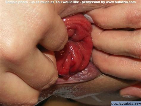 extreme prolapse and gape ass out fetish porn pic