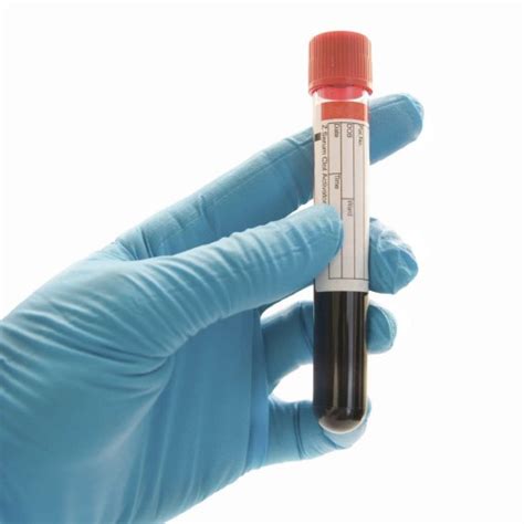long  alcohol stay   system blood urine hair  tests