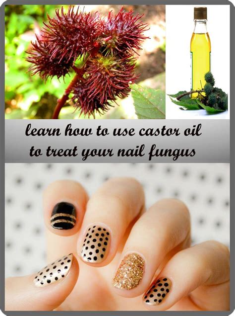 castor oil  nail fungus femininetipsnet nail oil