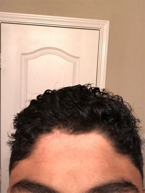 15 Male Why Is My Hairline So Messed Up What Are Some Good Styles To