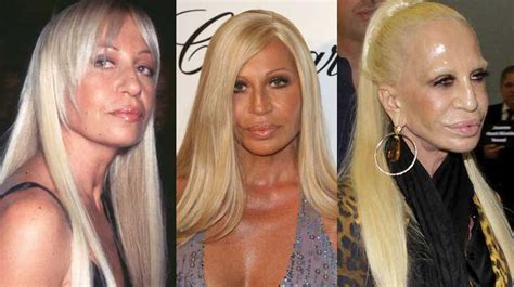 Donatella Versace Plastic Surgery Before And After Pictures 2018