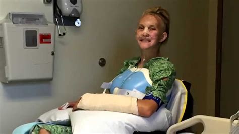 teen paralyzed in atv crash seeking help youtube