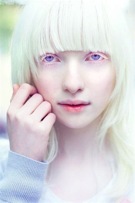 The Gorgeous Russian Albino Model Nastya Kiki Zhidkova Kumarov Is
