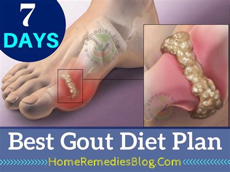 day gout diet plan  dobraemeryturaorg