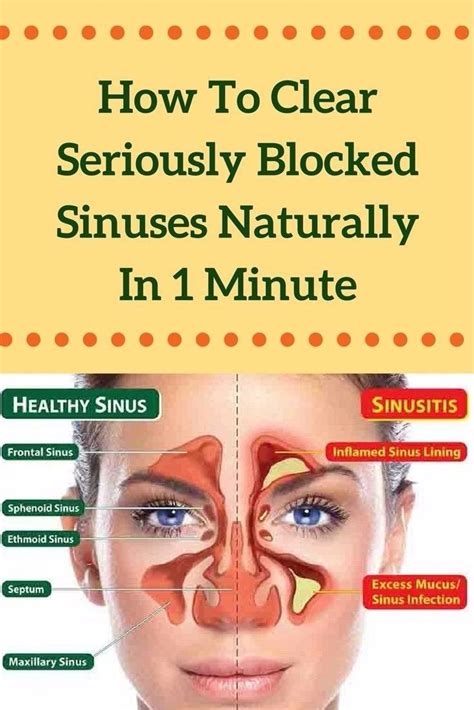 clear  blocked sinuses naturally   minute