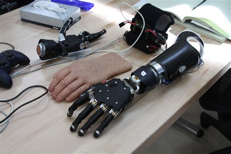 robot arm prosthetic controlled  thought