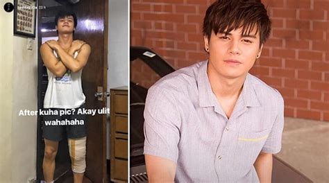 Ronnie Alonte Now Recovering From Knee Surgery Push Com Ph Your