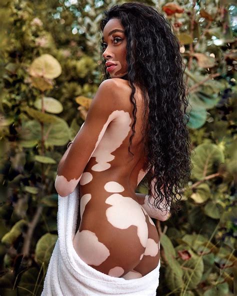 winnie harlow nude fappening 2 photos the fappening