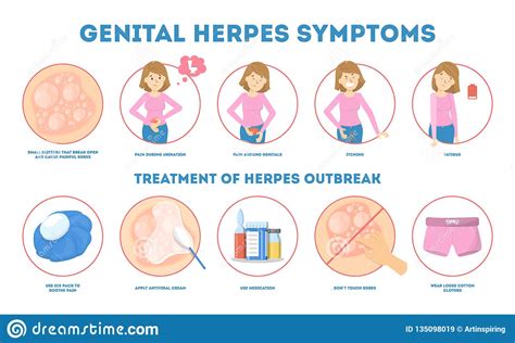 Genital Herpes Symptoms Infectious Dermatology Disease Illustration