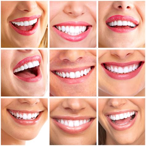 cosmetic dentistry  concord nh   generations dental blog