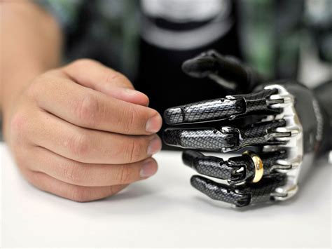 7 real life cyborg implants