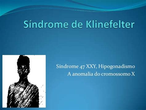 Síndrome De Klinefelter