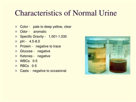 assessing clients  urinary elimination disorders powerpoint