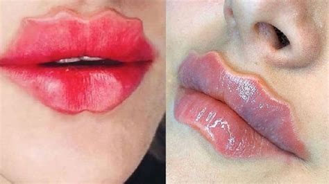 bizarre beauty trend makes russian girls go crazy for wavy lips odd news