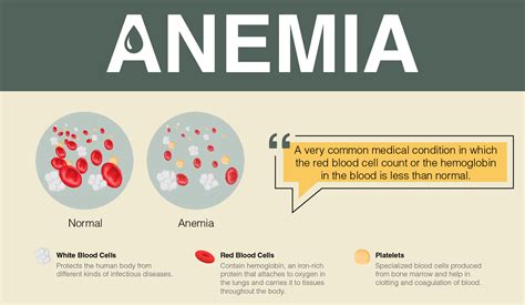 overview  anemia signs symptoms   treatment