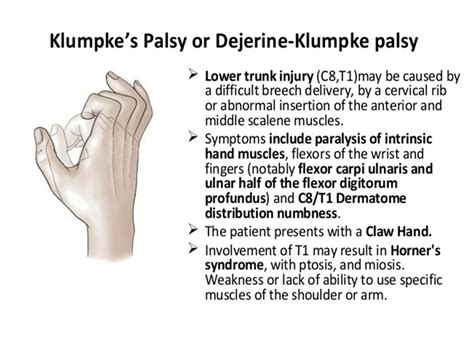 image result  klumpkes palsy brachial upper limb anatomy anatomy coloring book