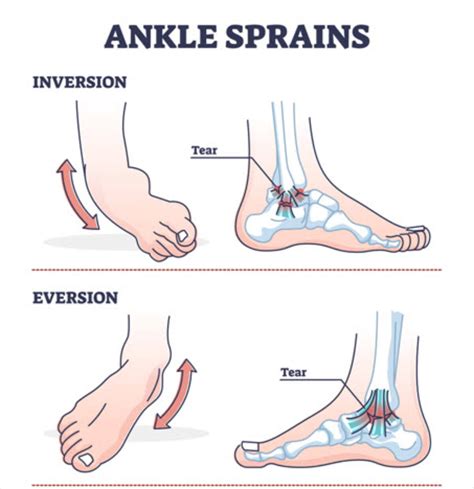 eversion  ankle