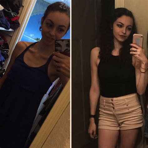 Anorexic Girl 14 Weighing Just Six Stone Hospitalised After Mum Told