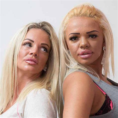 mom daughter duo drop 80 000 on plastic surgery together e online