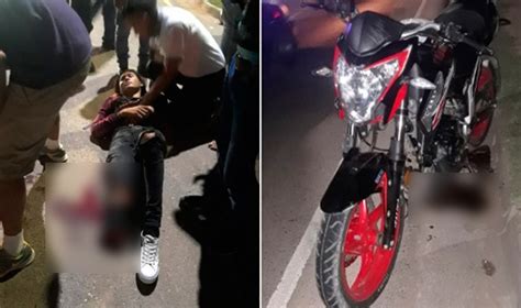 Joven Pierde Uno De Sus Pies En Accidente De Motocicleta El Pais