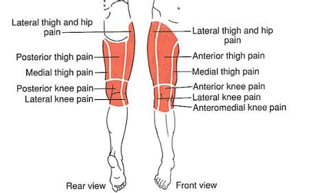 hip thigh knee  trigger point referred pain guide