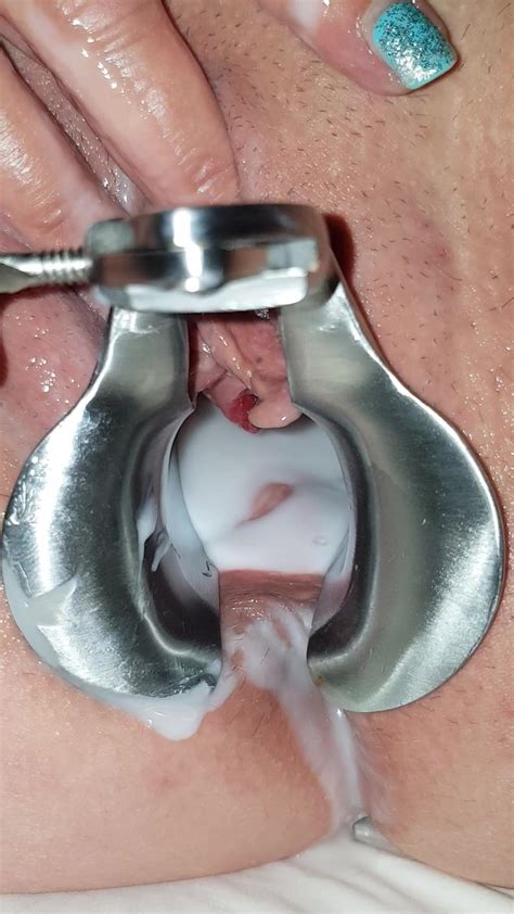 my wife s spunk filled speculum spread pussy free porn eb