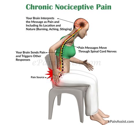 Chronic Nociceptive Pain Classification Anatomy Causes