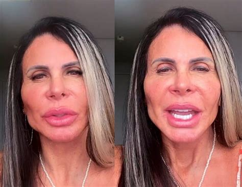 gretchen retoca harmonizacao facial tudo bonito de novo celebridades