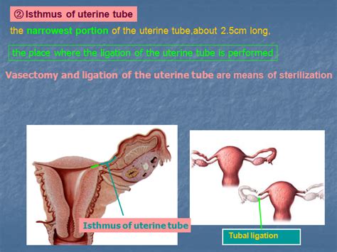 Mbbs Medicine Humanity First Female Genital System