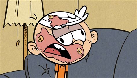 Image S1e18b Zombie Bran Lincoln Png The Loud House