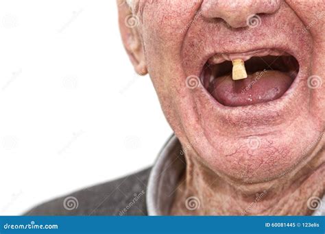 teeth stock photo image