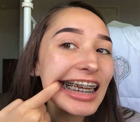 elastics braces girlswithbraces in 2019 teeth braces cute braces black braces