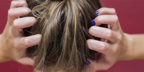 10 Reasons Your Scalp Might Be Itchy — And What To Do