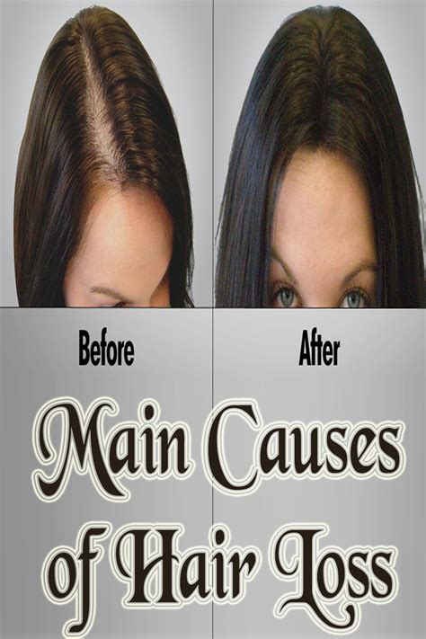 main   hair loss fit result