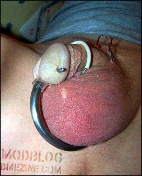 Female reroute urethra anal