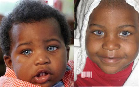 Haiti Chérie Black People With Blue Eyes