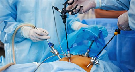 laparoscopy surgery benefits risk    procedure