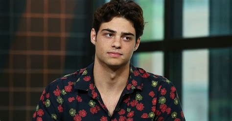 noah centineo explained how he got the scar on his face