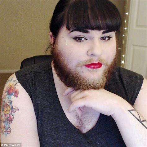 woman with pcos grows a full beard after finding love