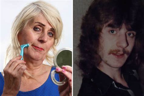 Before after pictures sex changes