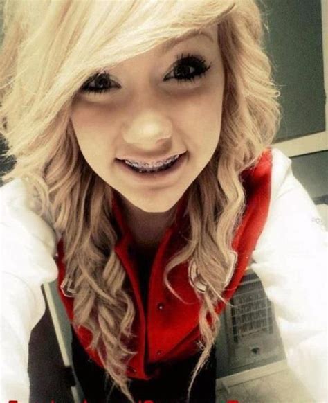 i would never look so good with braces i love braces and guys with braces xd