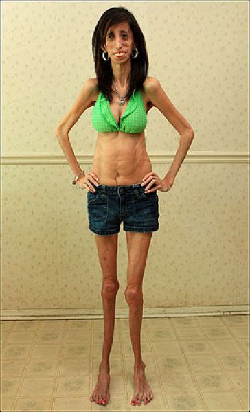 the story of 21 year old lizzie velasquez 17 pics