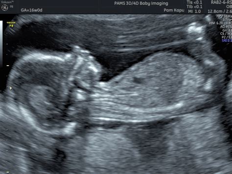 gender reveal scan private one on one pregnancy and fertility