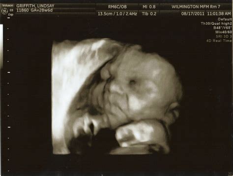 growing baby   week   days ultrasound