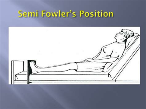 mobility  immobility chapter  powerpoint    id