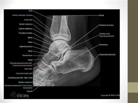 ankle joint radiography