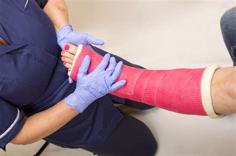 ladies leg  cast  treated   nurse hurstville physio