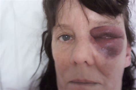 Hungarian Man Jailed For Repeatedly Smashing Granny With