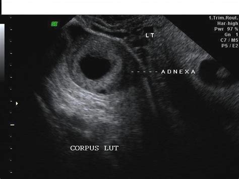 a gallery of high resolution ultrasound color doppler and 3d images